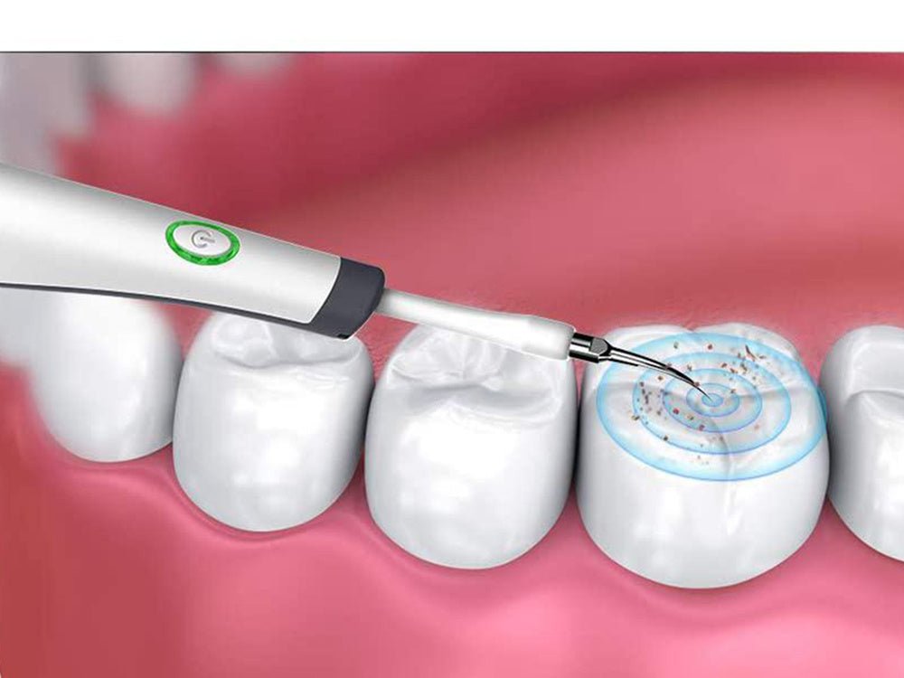 Cepillo Ultrasonico Dental