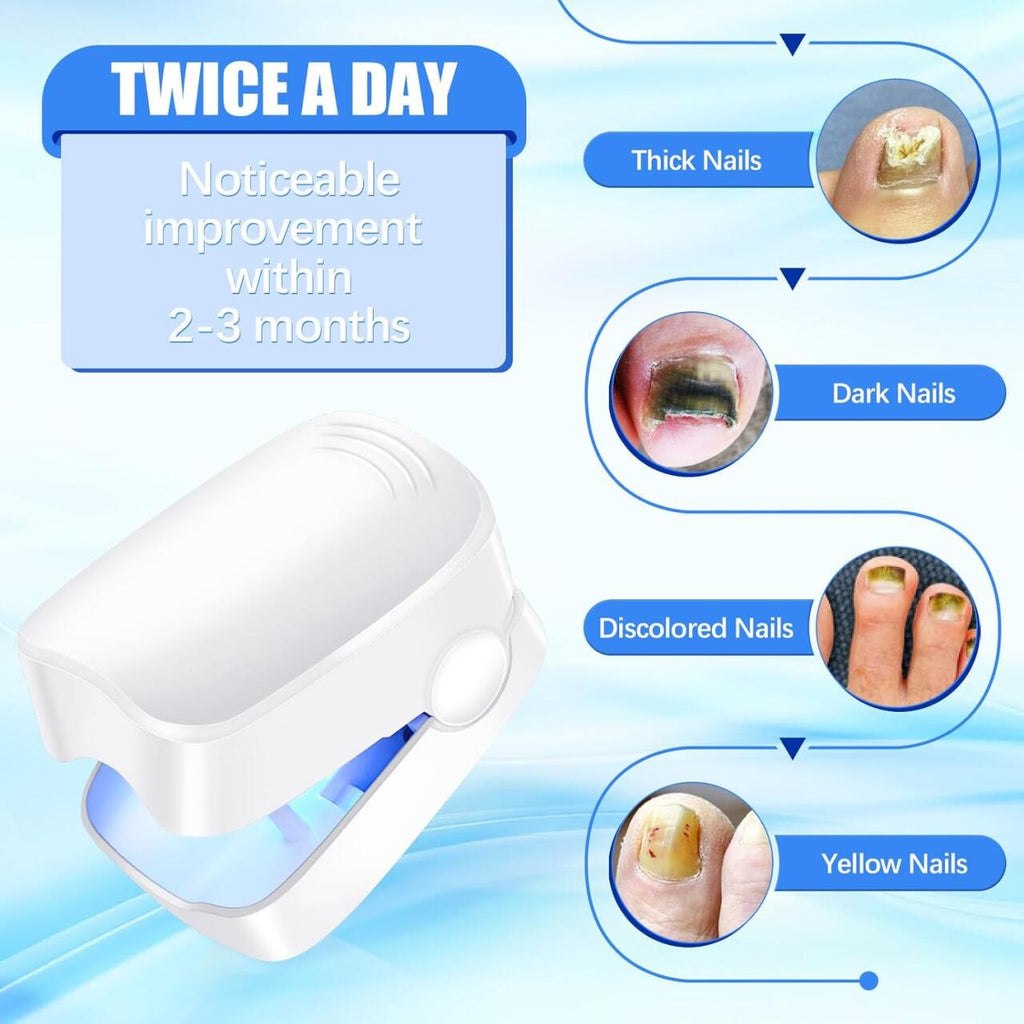 Dispositivo Láser para Tratamiento de Hongos Uñas